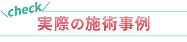実際の施術事例